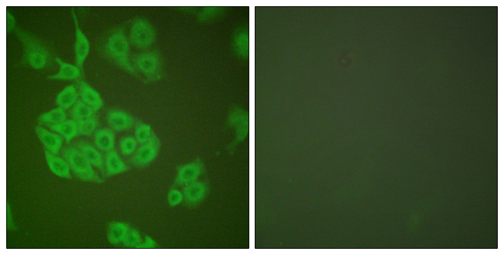 MMP11 Antibody - Immunofluorescence analysis of A549 cells, using MMP-11 Antibody. The picture on the right is blocked with the synthesized peptide.