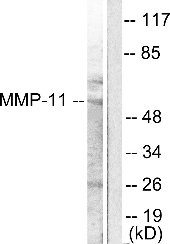 MMP11 Antibody - Western blot analysis of lysates from A549 cells, using MMP-11 Antibody. The lane on the right is blocked with the synthesized peptide.