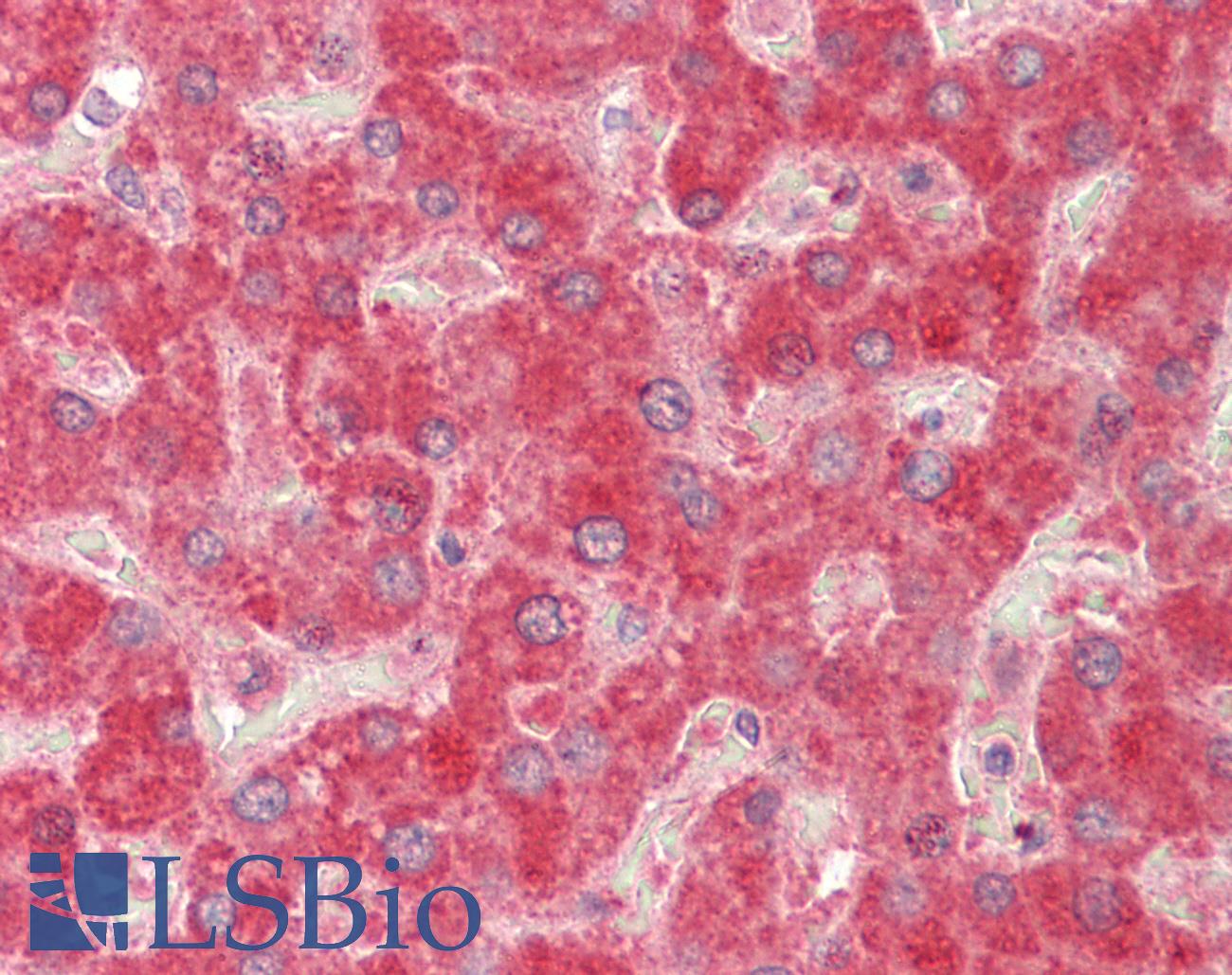 MMP14 Antibody - Anti-MMP14 antibody IHC staining of human liver. Immunohistochemistry of formalin-fixed, paraffin-embedded tissue after heat-induced antigen retrieval. Antibody concentration 5 ug/ml.