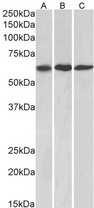 MMP14 Antibody - Goat Anti-MMP14 Antibody (1µg/ml) staining of NIH3T3, (A) A549 (B) and HeLa (C) lysates (35µg protein in RIPA buffer). Primary incubation was 1 hour. Detected by chemiluminescencence.