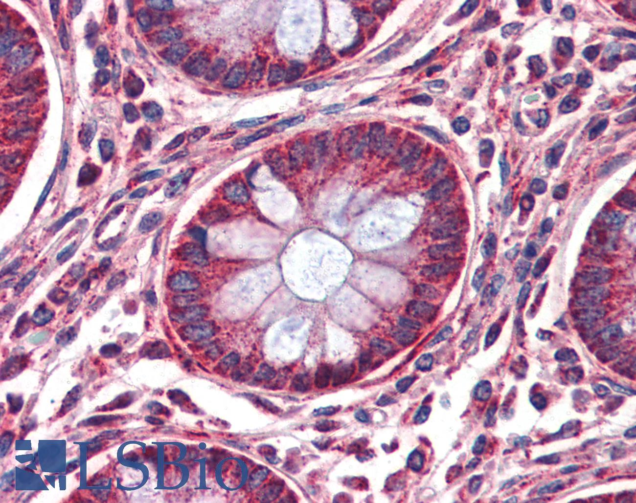 MMP14 Antibody - Anti-MMP14 antibody IHC of human colon. Immunohistochemistry of formalin-fixed, paraffin-embedded tissue after heat-induced antigen retrieval. Antibody concentration 10 ug/ml.