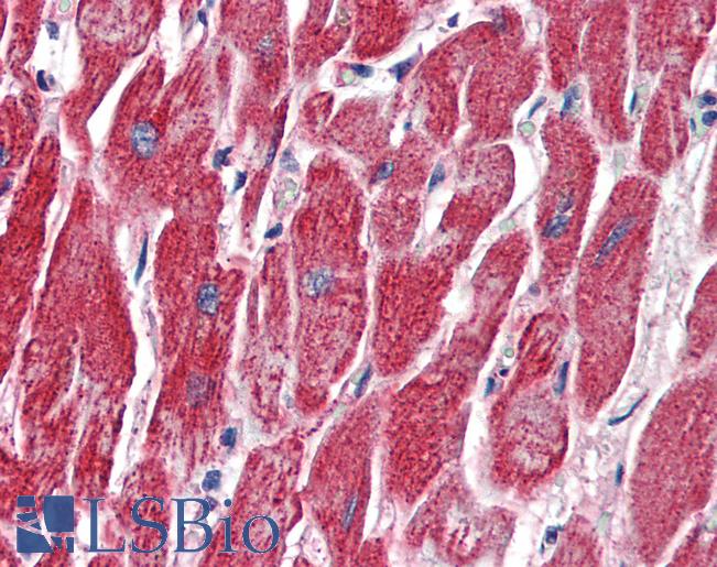 MMP14 Antibody - Anti-MMP14 antibody IHC of human heart. Immunohistochemistry of formalin-fixed, paraffin-embedded tissue after heat-induced antigen retrieval. Antibody concentration 10 ug/ml.