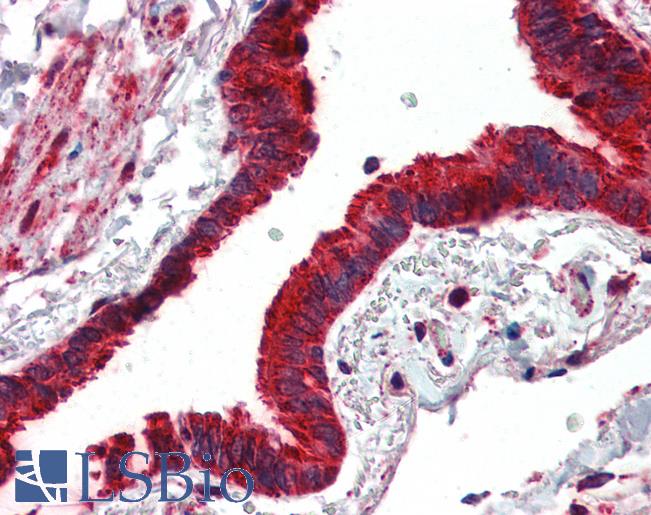 MMP14 Antibody - Anti-MMP14 antibody IHC of human lung, respiratory epithelium. Immunohistochemistry of formalin-fixed, paraffin-embedded tissue after heat-induced antigen retrieval. Antibody concentration 10 ug/ml.