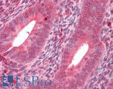 MMP14 Antibody - Human Uterus: Formalin-Fixed, Paraffin-Embedded (FFPE)