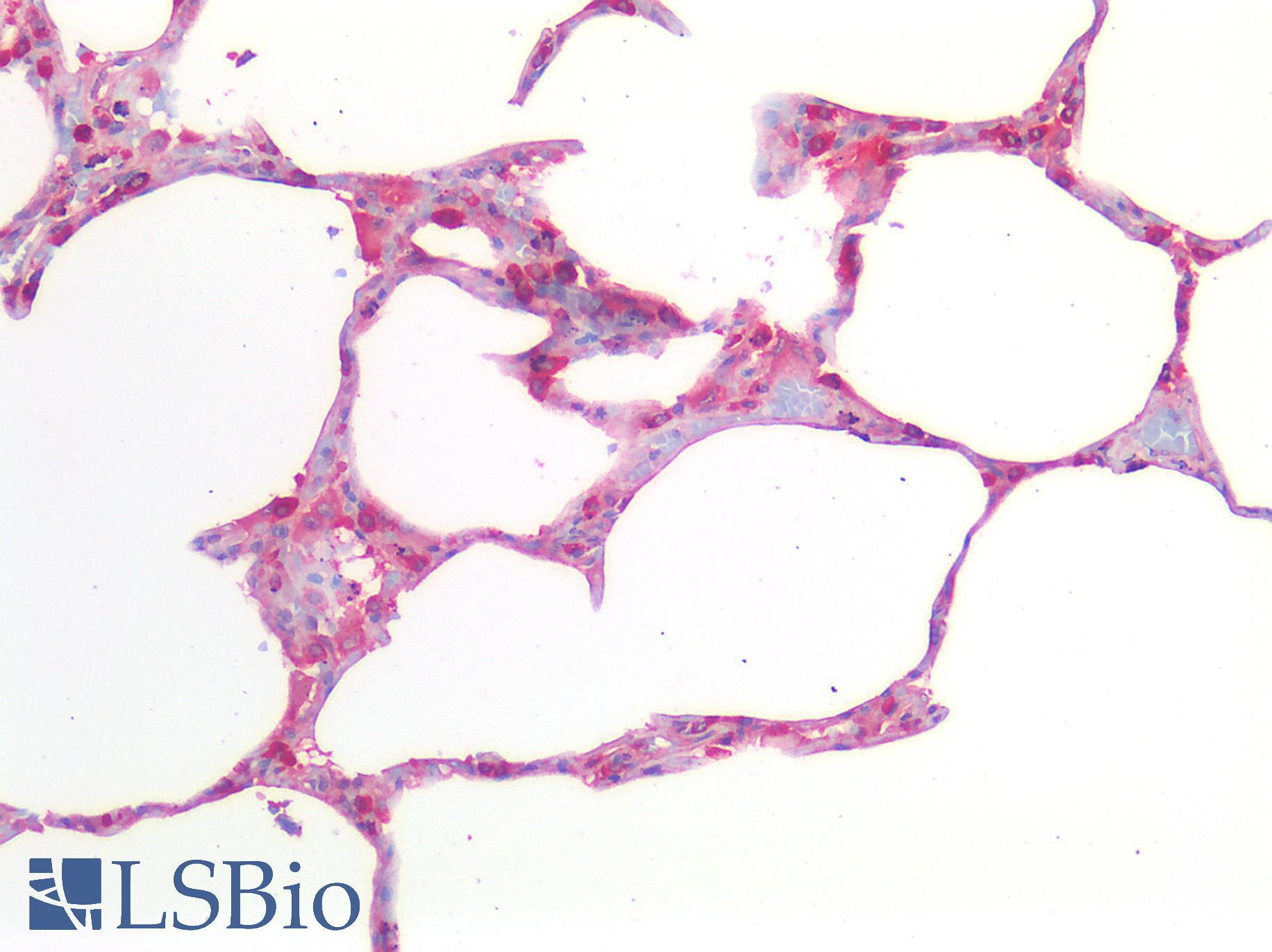 MMP2 Antibody - Human Lung: Formalin-Fixed, Paraffin-Embedded (FFPE)
