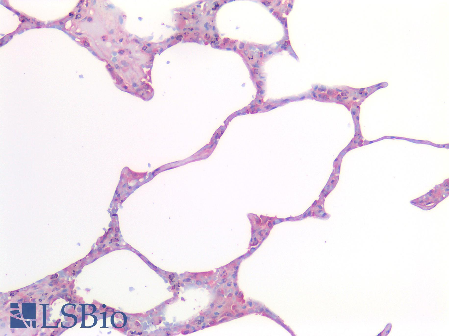 MMP2 Antibody - Human Lung: Formalin-Fixed, Paraffin-Embedded (FFPE)