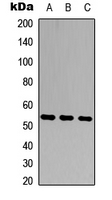 MMP20 Antibody - Western blot analysis of MMP20 expression in HEK293T (A); Raw264.7 (B); PC12 (C) whole cell lysates.