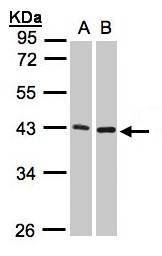 MMP3 Antibody - Sample(30 ug whole cell lysate). A:293T. B: Raji. 10% SDS PAGE. MMP3 antibody diluted at 1:1000.