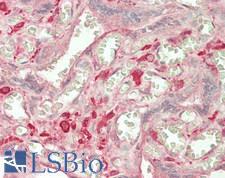 MMP7 / Matrilysin Antibody - Human Placenta: Formalin-Fixed, Paraffin-Embedded (FFPE)
