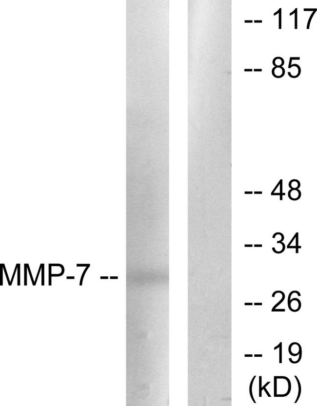 MMP7 / Matrilysin Antibody - Western blot analysis of lysates from COS7 cells, using MMP-7 Antibody. The lane on the right is blocked with the synthesized peptide.