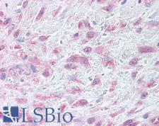 MMP9 / Gelatinase B Antibody - Anti-MMP9 antibody IHC of human skin, granulation tissue. Immunohistochemistry of formalin-fixed, paraffin-embedded tissue after heat-induced antigen retrieval.