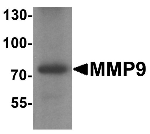 MMP9 / Gelatinase B Antibody - Western blot analysis of MMP9 in mouse lung tissue lysate with MMP9 antibody at 1 ug/ml.