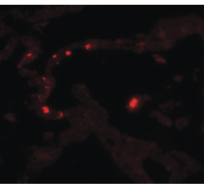 MMP9 / Gelatinase B Antibody - Immunofluorescence of MMP9 in human lung tissue with MMP9 antibody at 20 ug/ml.