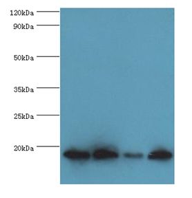 MMS2 / UBE2V2 Antibody - Western blot. All lanes: UBE2V2 antibody at 3 ug/ml. Lane 1: HeLa whole cell lysate. Lane 2: mouse brain tissue. Lane 3: Jurkat whole cell lysate. Lane 4: K562 whole cell lysate. secondary Goat polyclonal to rabbit at 1:10000 dilution. Predicted band size: 16 kDa. Observed band size: 16 kDa.