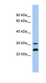 MMS21 / NSMCE2 Antibody - NSMCE2 / MMS21 antibody western blot of MCF7 cell lysate.  This image was taken for the unconjugated form of this product. Other forms have not been tested.