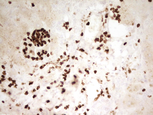 MNDA Antibody - IHC of paraffin-embedded Human liver tissue using anti-MNDA mouse monoclonal antibody. (Heat-induced epitope retrieval by 1 mM EDTA in 10mM Tris, pH8.5, 120°C for 3min).