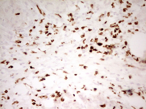 MNDA Antibody - IHC of paraffin-embedded Human pancreas tissue using anti-MNDA mouse monoclonal antibody. (Heat-induced epitope retrieval by 1 mM EDTA in 10mM Tris, pH8.5, 120°C for 3min).