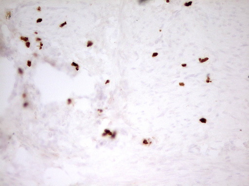 MNDA Antibody - IHC of paraffin-embedded Human endometrium tissue using anti-MNDA mouse monoclonal antibody. (Heat-induced epitope retrieval by 1 mM EDTA in 10mM Tris, pH8.5, 120°C for 3min).