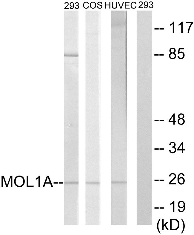 MOB1B / MOBKL1A Antibody - Western blot analysis of lysates from 293, COS7, and HUVEC cells, treated with IFN 2500U/ml 30', using MOL1A Antibody. The lane on the right is blocked with the synthesized peptide.