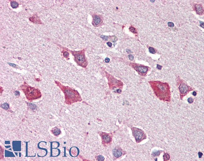 MOB4 / PHOCN Antibody - Anti-MOBKL3 / MOB1 antibody IHC staining of human brain, cortex. Immunohistochemistry of formalin-fixed, paraffin-embedded tissue after heat-induced antigen retrieval. Antibody concentration 5 ug/ml.