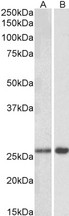 MOB4 / PHOCN Antibody - Goat Anti-MOBKL3 (aa137-151) Antibody (0.3µg/ml) staining of Mouse Brain lysate (A) and (1µg/ml) staining of Rat Brain lysate (B) (35µg protein in RIPA buffer). Primary incubation was 1 hour. Detected by chemiluminescencence.