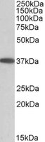 MOGAT2 Antibody - MOGAT2 antibody (0.05 ug/ml) staining of Human Duodenum lysate (35 ug protein/ml in RIPA buffer). Primary incubation was 1 hour. Detected by chemiluminescence.