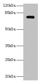 MON1A / SAND1 Antibody - Western blot All lanes: Vacuolar fusion protein MON1 homolog A antibody at 2µg/ml + U251 whole cell lysate Secondary Goat polyclonal to rabbit IgG at 1/10000 dilution Predicted band size: 63, 45, 34, 56 kDa Observed band size: 63 kDa