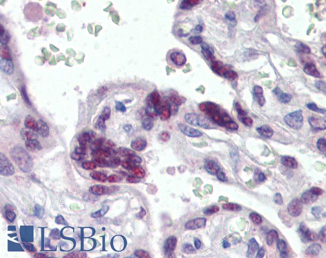 MORF4L1 / MRG15 Antibody - Anti-MORF4L1 / MRG15 antibody IHC of human placenta. Immunohistochemistry of formalin-fixed, paraffin-embedded tissue after heat-induced antigen retrieval. Antibody concentration 2.5 ug/ml.