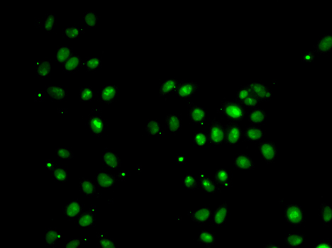 MORF4L1 / MRG15 Antibody - Immunofluorescence analysis of A549 cell using MORF4L1 antibody.