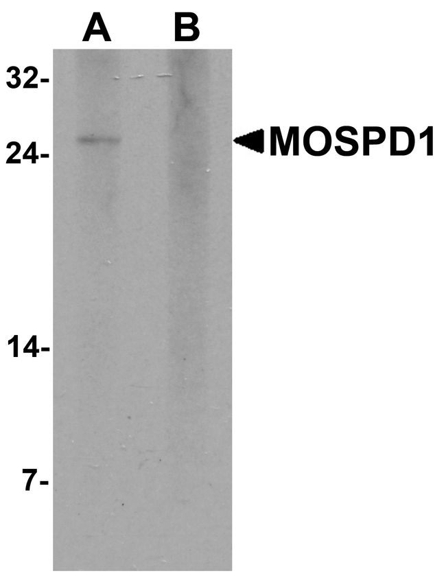 MOSPD1 Antibody - Western blot analysis of MOSPD1 in human brain tissue lysate with MOSPD1 antibody at 1 ug/ml in (A) the absence and (B) the presence of blocking peptide.