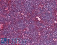 MRE11A / MRE11 Antibody - Anti-MRE11A / MRE11 antibody IHC of human thymus. Immunohistochemistry of formalin-fixed, paraffin-embedded tissue after heat-induced antigen retrieval. Antibody concentration 5 ug/ml.
