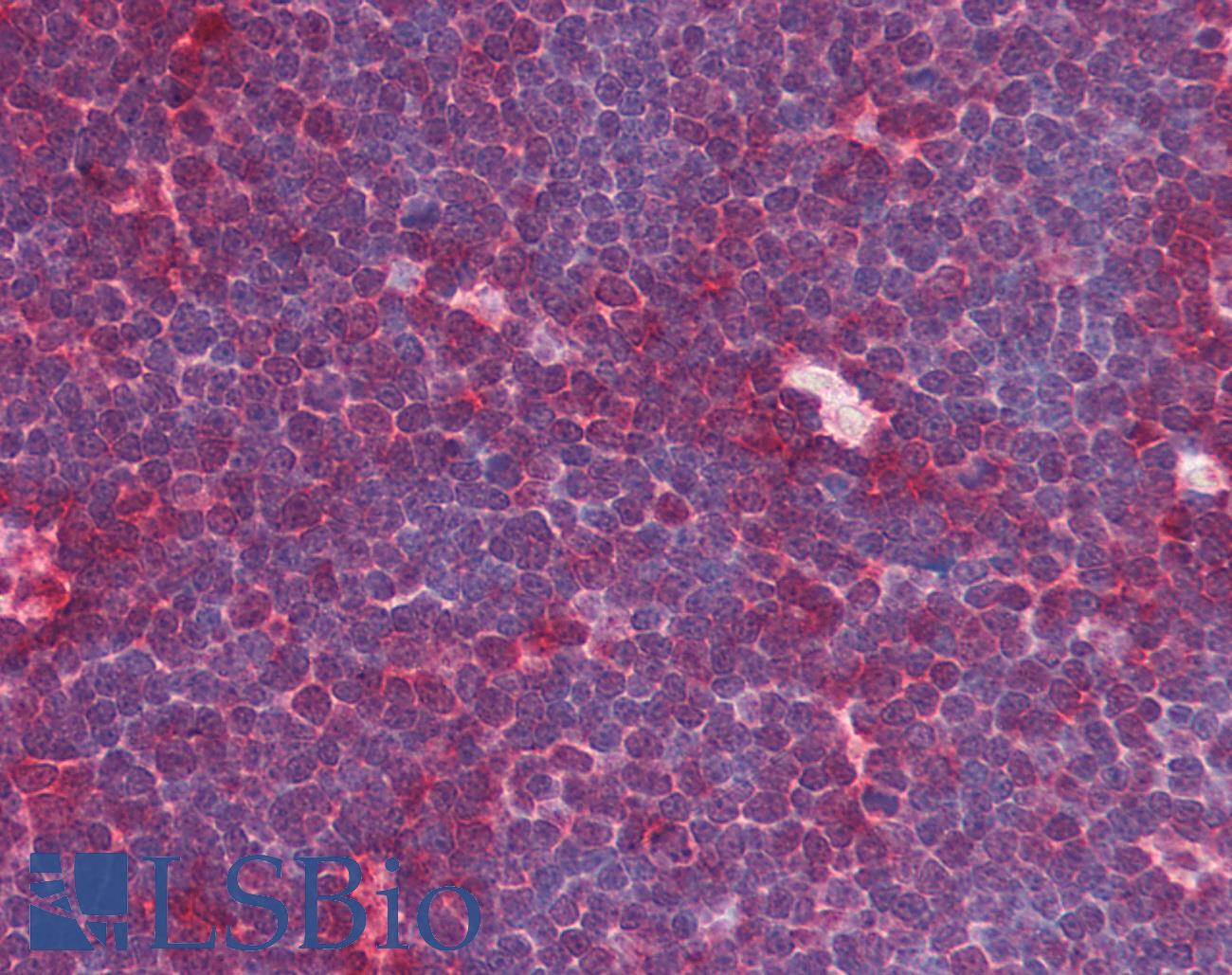 MRE11A / MRE11 Antibody - Anti-MRE11A / MRE11 antibody IHC of human thymus. Immunohistochemistry of formalin-fixed, paraffin-embedded tissue after heat-induced antigen retrieval. Antibody concentration 5 ug/ml.