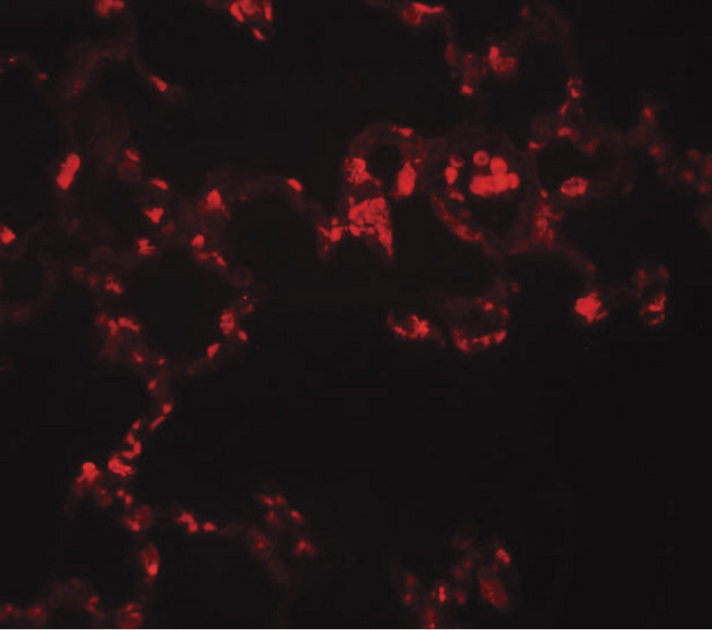MRE11A / MRE11 Antibody - Immunofluorescence of MRE11 in rat lung tissue with MRE11 antibody at 20 ug/ml.