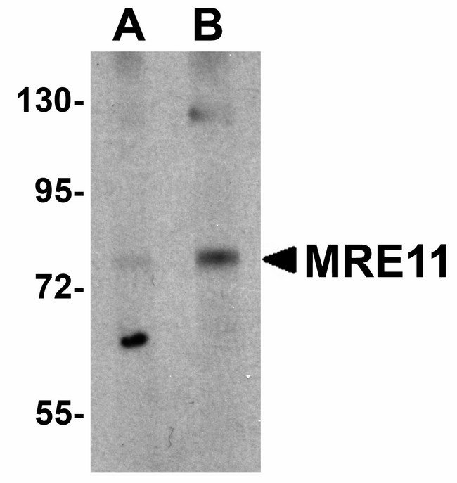 MRE11A / MRE11 Antibody - Western blot of MRE11 in rat lung tissue lysate with MRE11 antibody at (A) 1 and (B) 2 ug/ml.
