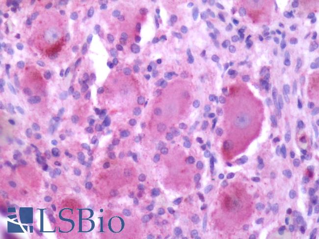 MRGPRX2 / MRGX2 Antibody - Anti-MRGPRX2 / MRGX2 antibody IHC of human spinal cord, dorsal root ganglion. Immunohistochemistry of formalin-fixed, paraffin-embedded tissue after heat-induced antigen retrieval.