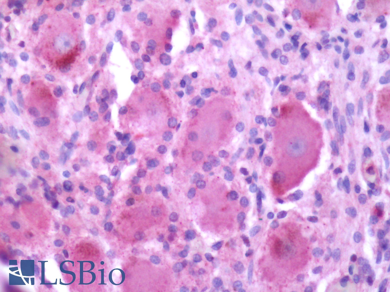 MRGPRX2 / MRGX2 Antibody - Anti-MRGPRX2 / MRGX2 antibody IHC of human spinal cord, dorsal root ganglion. Immunohistochemistry of formalin-fixed, paraffin-embedded tissue after heat-induced antigen retrieval.