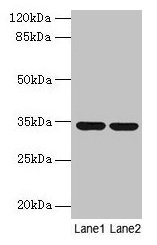 MRPL19 Antibody - Western blot All lanes: 39S ribosomal protein L19, mitochondrial antibody at 2µg/ml Lane 1: MCF-7 whole cell lysate Lane 2: Mouse liver tissue Secondary Goat polyclonal to rabbit IgG at 1/10000 dilution Predicted band size: 34 kDa Observed band size: 34 kDa