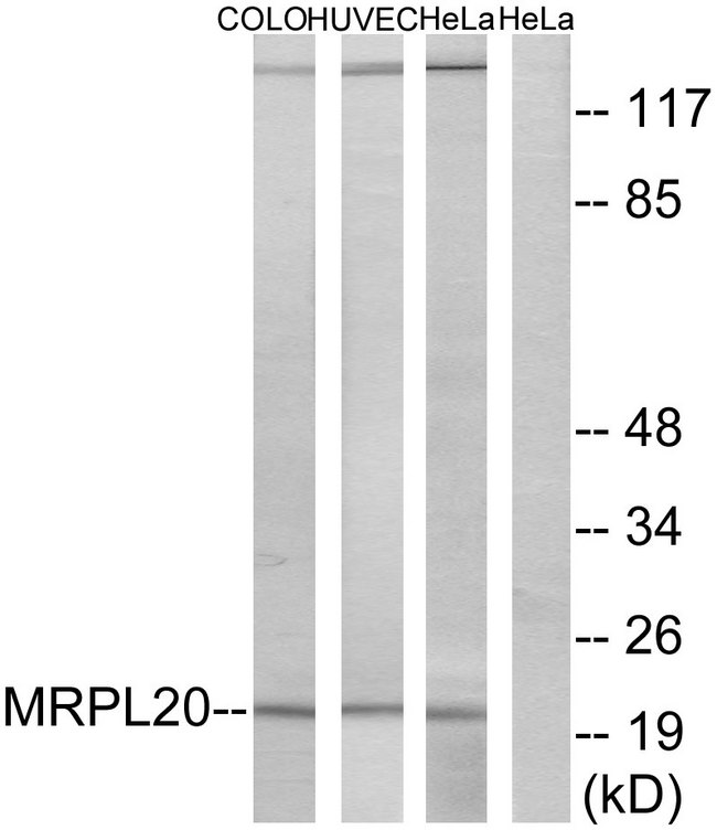 MRPL20 Antibody - Western blot analysis of lysates from Hela, HUVEC, and COLO cells, using MRPL20 Antibody. The lane on the right is blocked with the synthesized peptide.