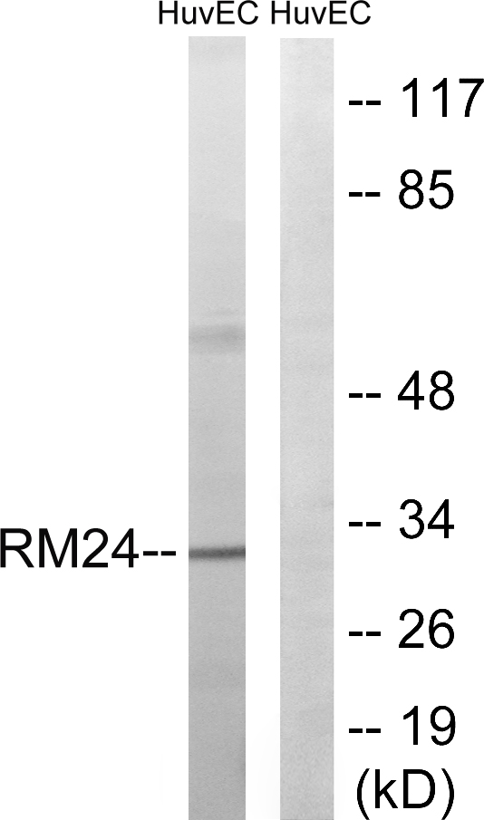 MRPL24 Antibody - Western blot analysis of lysates from HUVEC cells, using MRPL24 Antibody. The lane on the right is blocked with the synthesized peptide.