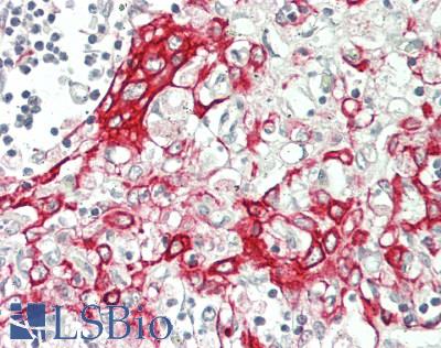 MRPL39 Antibody - Human Thymus: Formalin-Fixed, Paraffin-Embedded (FFPE)