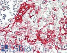 MRPL39 Antibody - Human Thymus: Formalin-Fixed, Paraffin-Embedded (FFPE)