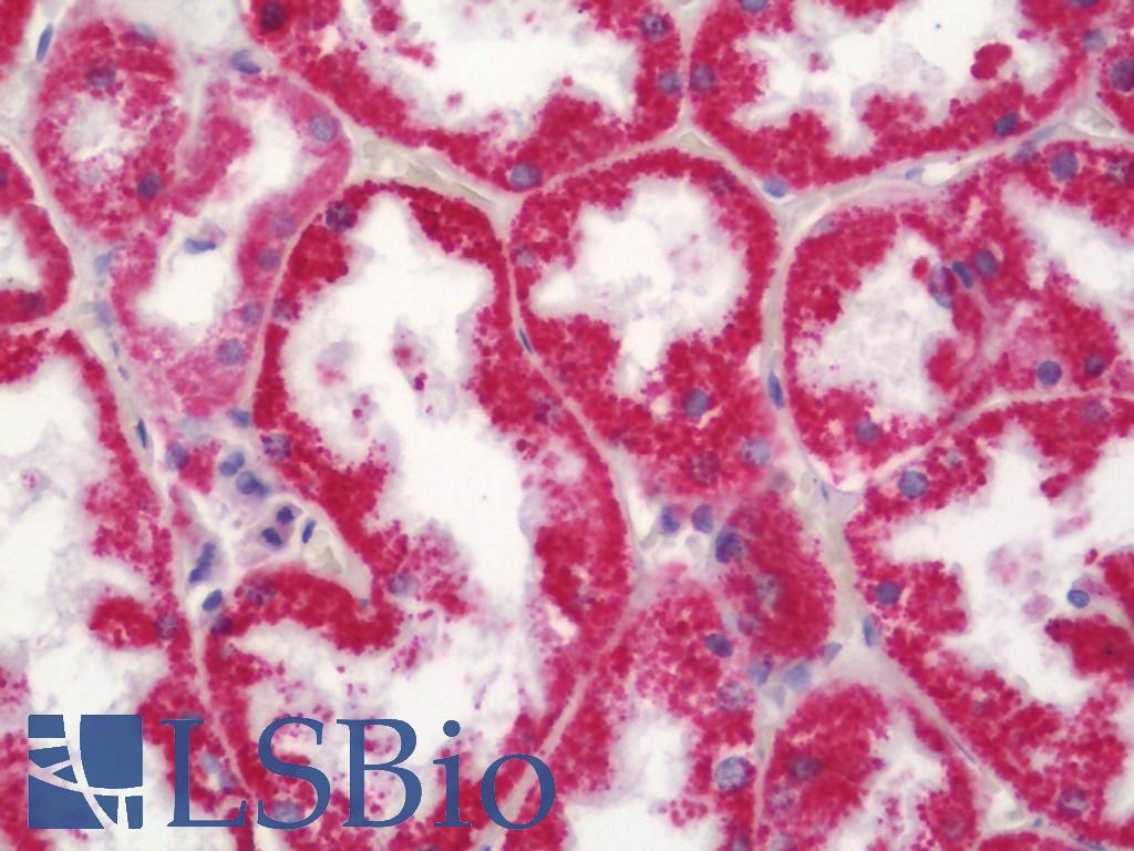 MRPL41 / PIG3 / BMRP Antibody - Human Kidney: Formalin-Fixed, Paraffin-Embedded (FFPE)