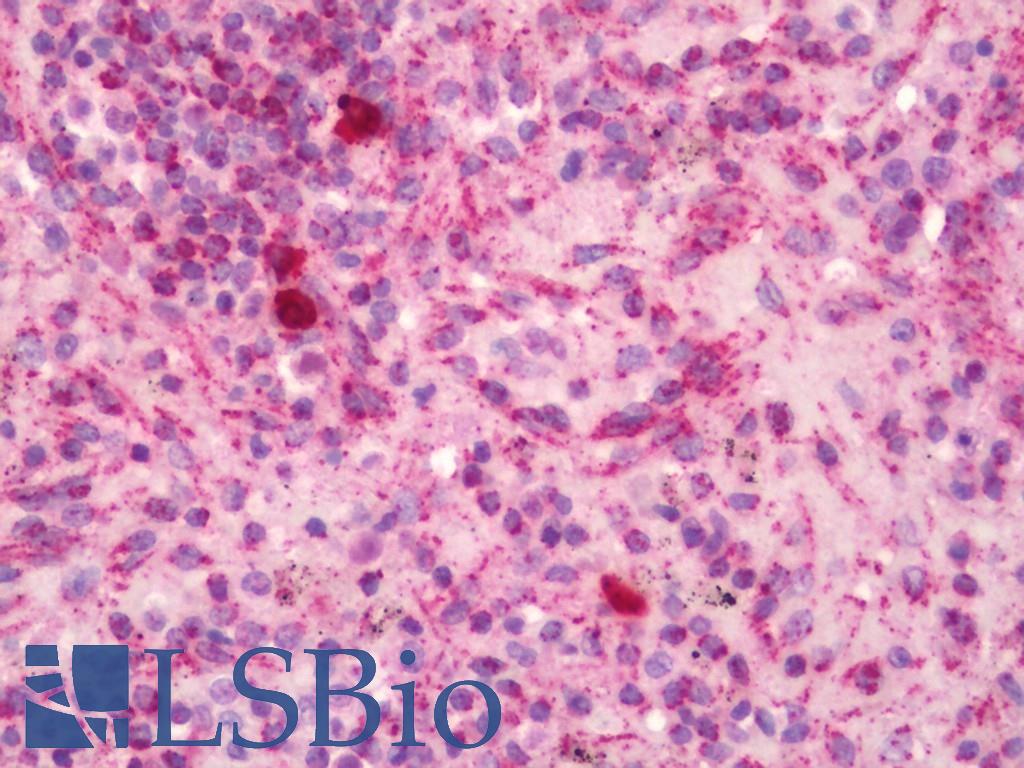 MRPL41 / PIG3 / BMRP Antibody - Human Spleen: Formalin-Fixed, Paraffin-Embedded (FFPE)