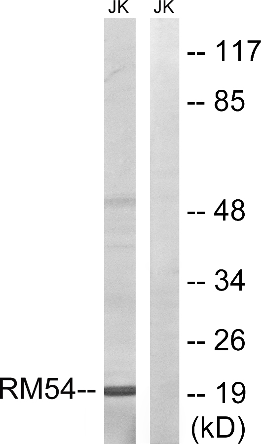 MRPL54 Antibody - Western blot analysis of lysates from Jurkat cells, using MRPL54 Antibody. The lane on the right is blocked with the synthesized peptide.