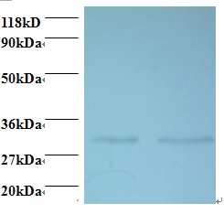 MRPL9 Antibody - Western blot of 39S ribosomal protein L9, mitochondrial antibody at 2 ug/ml. Lane 1: EC109 whole cell lysate. Lane 2: 293T whole cell lysate. Secondary: Goat polyclonal to Rabbit IgG at 1:15000 dilution. Predicted band size: 29.6 kDa. Observed band size: 29.6 kDa.  This image was taken for the unconjugated form of this product. Other forms have not been tested.
