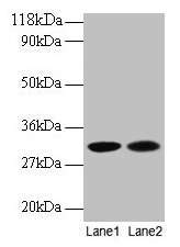 MRPL9 Antibody - Western blot All lanes: 39S ribosomal protein L9, mitochondrial antibody at 2µg/ml Lane 1: EC109 whole cell lysate Lane 2: 293T whole cell lysate Secondary Goat polyclonal to rabbit IgG at 1/15000 dilution Predicted band size: 29.6 kDa Observed band size: 29.6 kDa