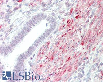 MRPS18C Antibody - Human Uterus: Formalin-Fixed, Paraffin-Embedded (FFPE)