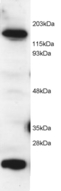MS / MTR Antibody - Antibody (2 ug/ml) staining of HeLa lysate (RIPA buffer, 1.4E5 cells per lane). Detected by Western blot of chemiluminescence.