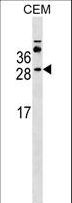 MS4A3 Antibody - MS4A3 Antibody western blot of CEM cell line lysates (35 ug/lane). The MS4A3 antibody detected the MS4A3 protein (arrow).