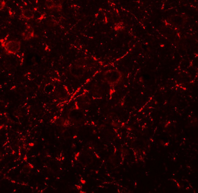 MS4A6A / MS4A Antibody - Immunofluorescence of MS4A6A in rat brain tissue with MS4A6A antibody at 20 µg/mL.